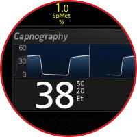 Rad-97 monitor displaying real-time EtCO2 waveform for easy interpretation of capnography measurements.