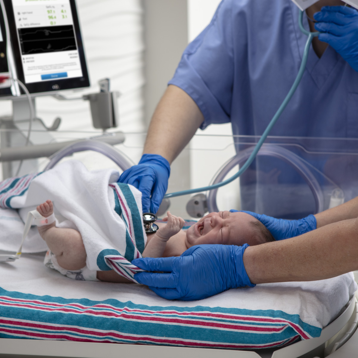 Neonato sottoposto a screening dai medici mediante stetoscopio e monitorato con un sensore per pulsossimetria Masimo Newborn.